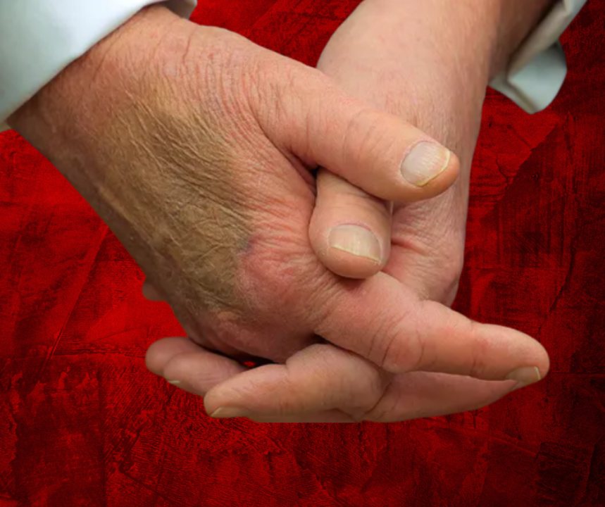 White House Responds to Trump’s Hand Bruise Photo
