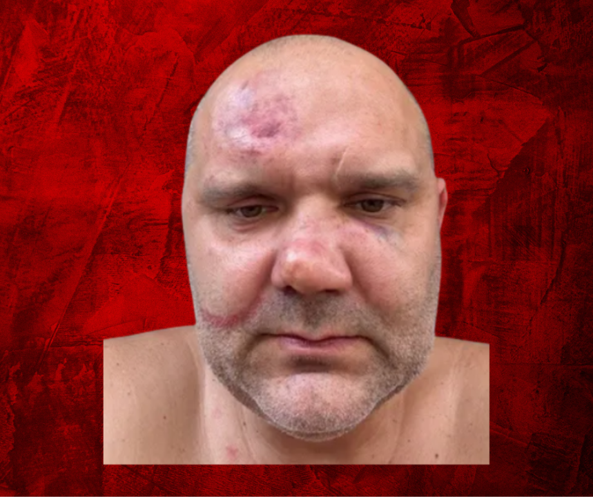 White Victim in Viral Cincinnati Beating Charged, Union Raises Alarm