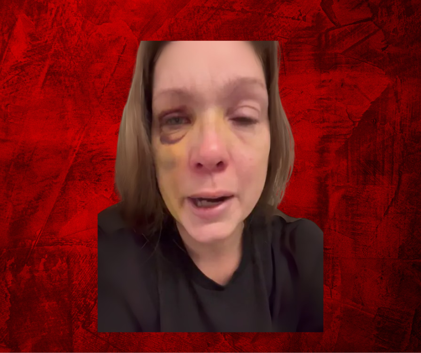 Cincinnati Mom Breaks Down After Brutal Street Attack